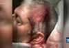 Hate Slur Sparks Chaos? Maui Cops Go Quiet California family ‘totally overwhelmed’ after large fight at Kaanapali resort