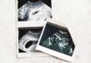 Ultrasound photo prints on a light surface