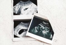 Ultrasound photo prints on a light surface