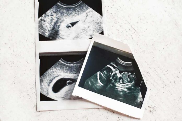 Ultrasound photo prints on a light surface