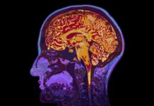 Human brain MRI side profile with colorful scan overlay