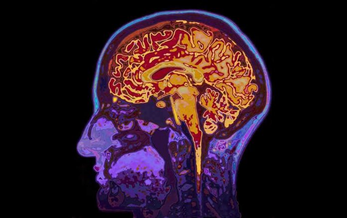 Human brain MRI side profile with colorful scan overlay